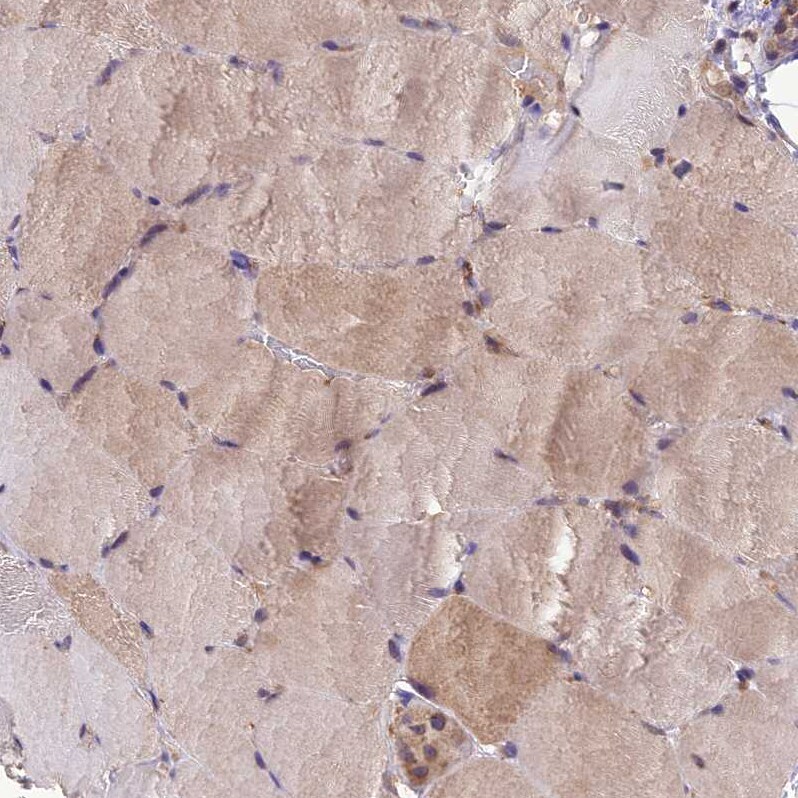 MIOS Antibody - BSA Free Immunohistochemistry: MIOS Antibody - BSA Free [NBP1-93980]