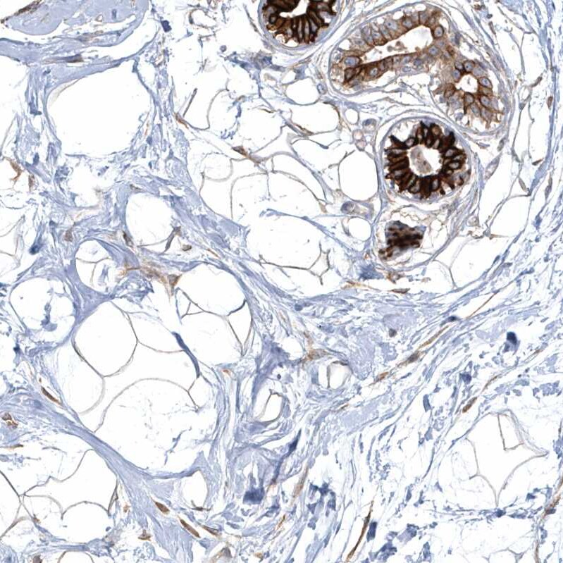 ARHGEF38 Antibody - BSA Free Immunohistochemistry: ARHGEF38 Antibody - BSA Free [NBP1-93985]