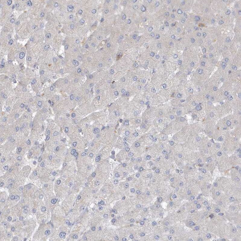 ARHGEF38 Antibody - BSA Free Immunohistochemistry: ARHGEF38 Antibody - BSA Free [NBP1-93985]