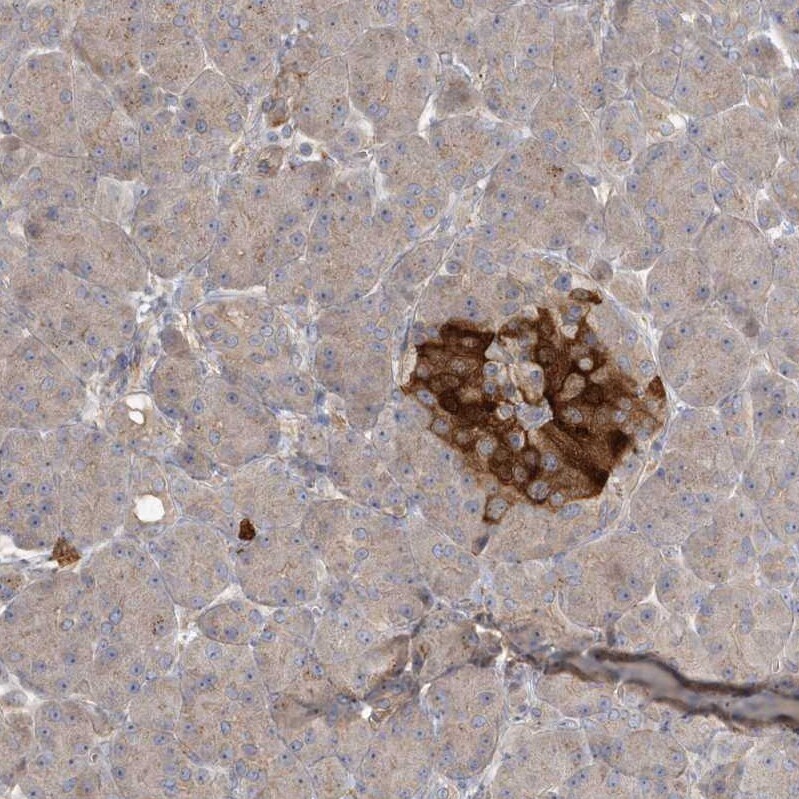 ARHGEF38 Antibody - BSA Free Immunohistochemistry: ARHGEF38 Antibody - BSA Free [NBP1-93985]