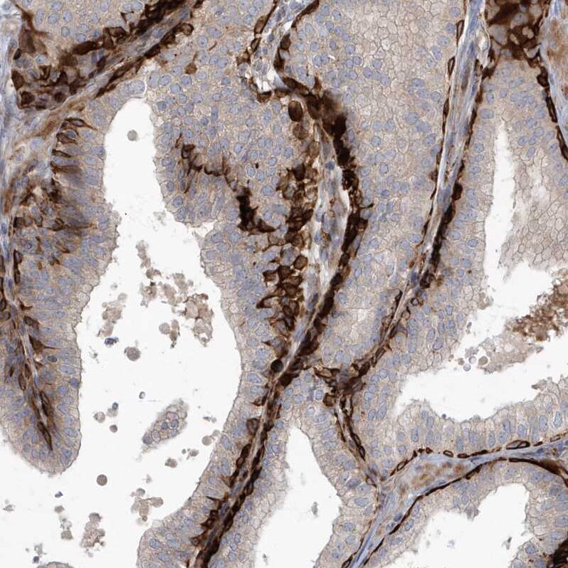 ARHGEF38 Antibody - BSA Free Immunohistochemistry: ARHGEF38 Antibody - BSA Free [NBP1-93985]
