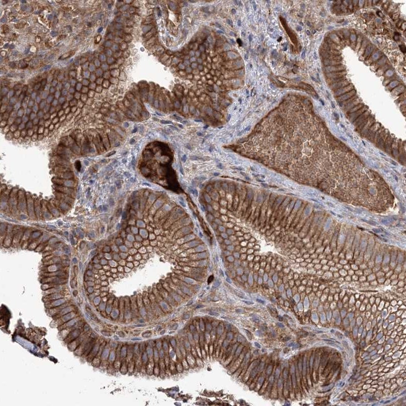 OPAL1 Antibody - BSA Free Immunohistochemistry: OPAL1 Antibody - BSA Free [NBP1-93988]