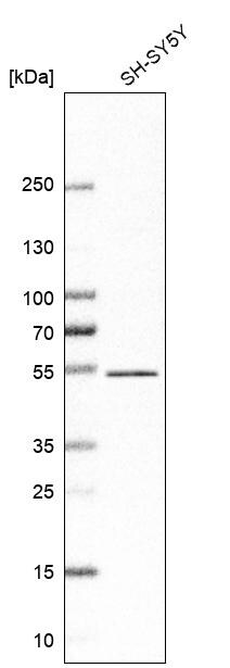 ZNF704 Antibody - BSA Free Western Blot: ZNF704 Antibody - BSA Free [NBP1-93998]