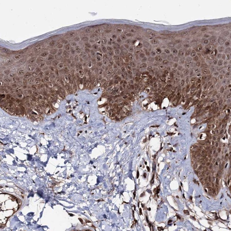 MICALCL Antibody - BSA Free Immunohistochemistry: MICALCL Antibody - BSA Free [NBP1-94001]