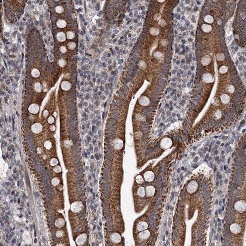 RITA Antibody - BSA Free Immunohistochemistry-Paraffin: RITA Antibody [NBP1-94003]