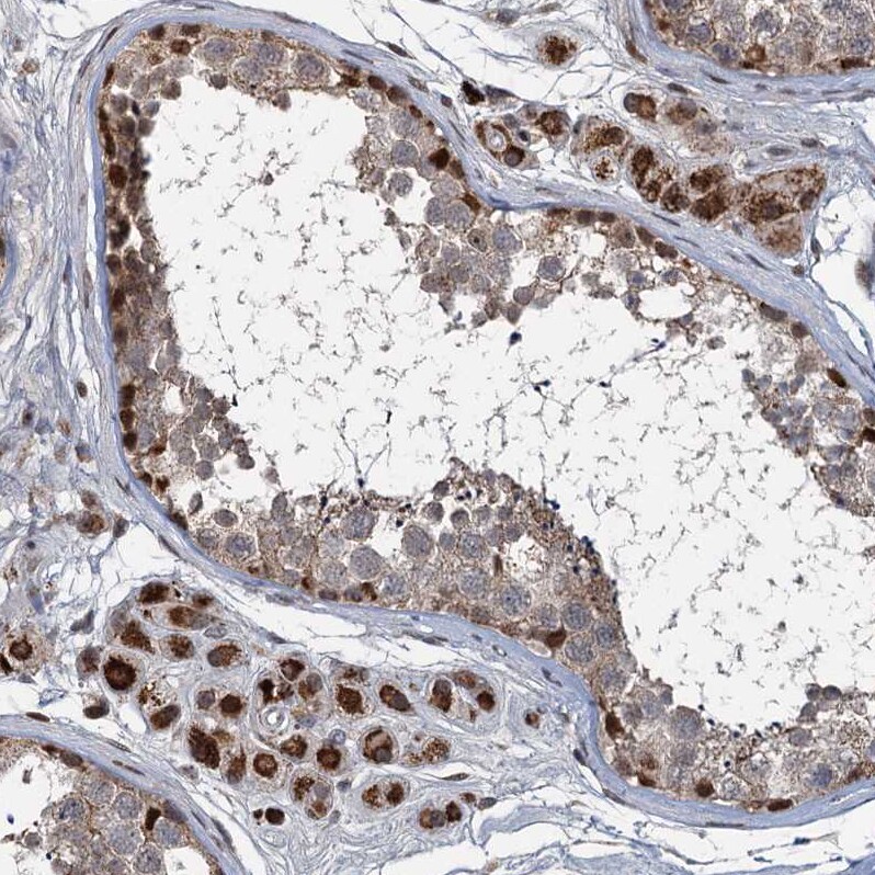 RITA Antibody - BSA Free Immunohistochemistry-Paraffin: RITA Antibody [NBP1-94003]