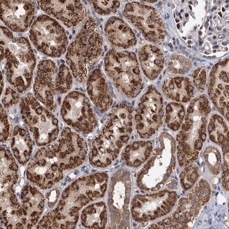 RITA Antibody - BSA Free Immunohistochemistry-Paraffin: RITA Antibody [NBP1-94003]