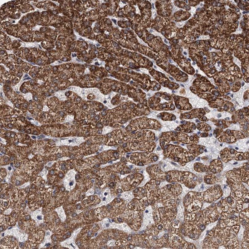 RITA Antibody - BSA Free Immunohistochemistry: RITA Antibody - BSA Free [NBP1-94003]