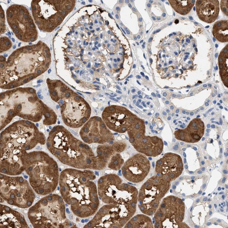 SLC35E1 Antibody - BSA Free Immunohistochemistry: SLC35E1 Antibody - BSA Free [NBP1-94009]