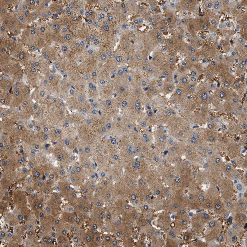 SLC35E1 Antibody - BSA Free Immunohistochemistry: SLC35E1 Antibody - BSA Free [NBP1-94009]