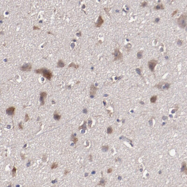 DIA1R Antibody - BSA Free Immunohistochemistry: DIA1R Antibody - BSA Free [NBP1-94010]