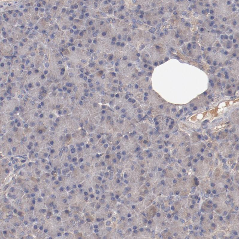 DIA1R Antibody - BSA Free Immunohistochemistry: DIA1R Antibody - BSA Free [NBP1-94010]