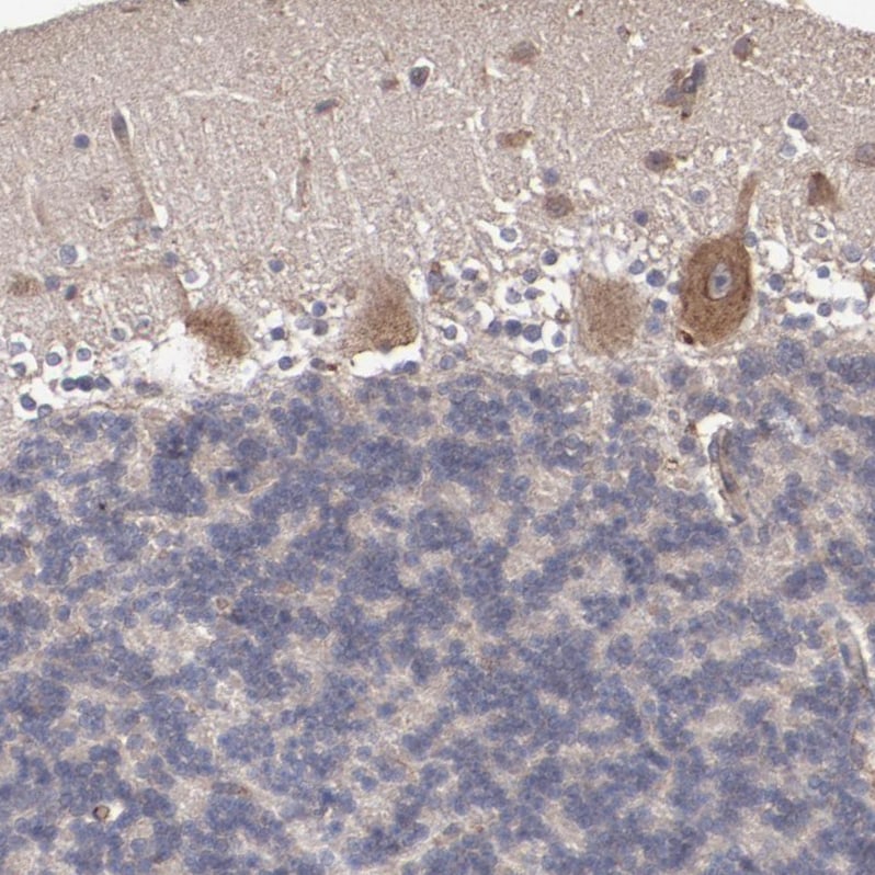 DIA1R Antibody - BSA Free Immunohistochemistry: DIA1R Antibody - BSA Free [NBP1-94010]