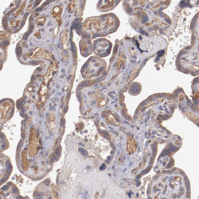DIA1R Antibody - BSA Free Immunohistochemistry: DIA1R Antibody - BSA Free [NBP1-94010]