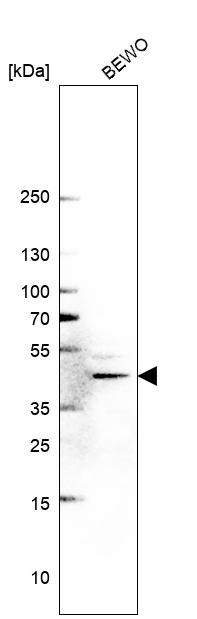 METTL8 Antibody - BSA Free Western Blot: METTL8 Antibody - BSA Free [NBP1-94012]
