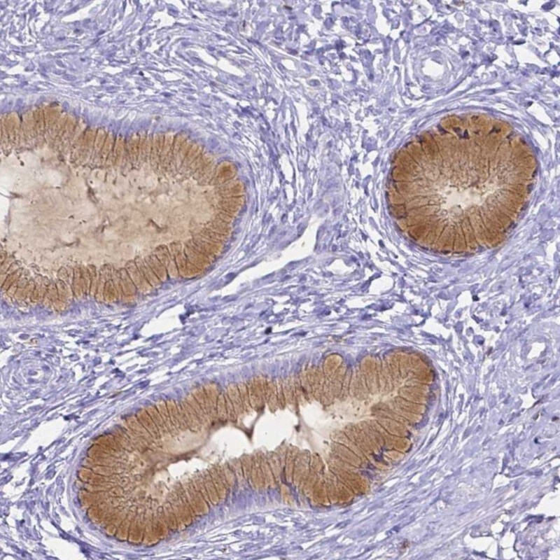 HSPA12A Antibody - BSA Free Immunohistochemistry: HSPA12A Antibody - BSA Free [NBP1-94014]