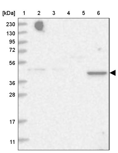 TRAPPC13 Antibody - BSA Free Western Blot: TRAPPC13 Antibody - BSA Free [NBP1-94021]