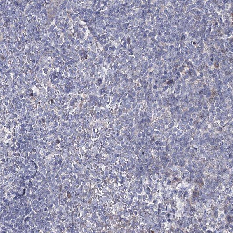 CPLANE1 Antibody - BSA Free Immunohistochemistry-Paraffin: CPLANE1 Antibody [NBP1-94023]