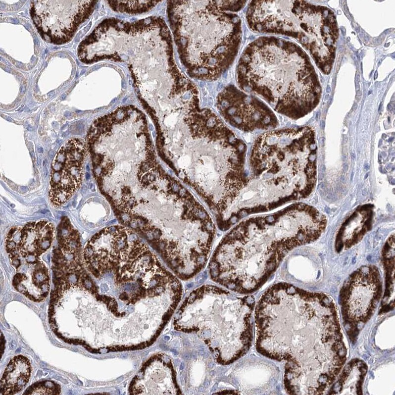 CPLANE1 Antibody - BSA Free Immunohistochemistry-Paraffin: CPLANE1 Antibody [NBP1-94023]