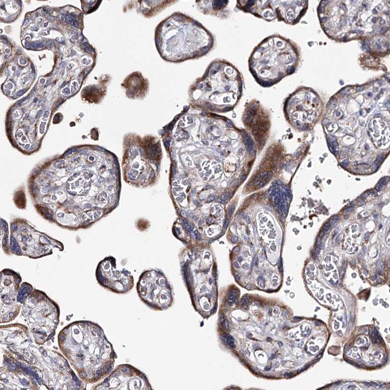 CPLANE1 Antibody - BSA Free Immunohistochemistry-Paraffin: CPLANE1 Antibody [NBP1-94023]