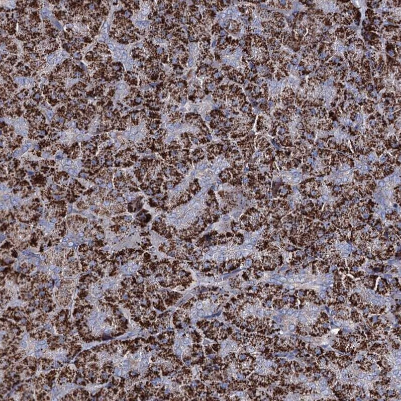 CPLANE1 Antibody - BSA Free Immunohistochemistry: CPLANE1 Antibody - BSA Free [NBP1-94023]