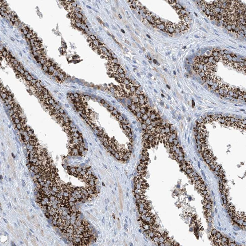 IBA57 Antibody - BSA Free Immunohistochemistry-Paraffin: IBA57 Antibody [NBP1-94027]