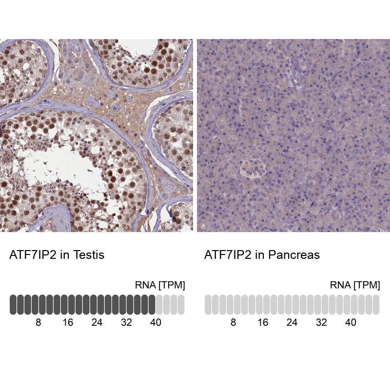 ATF7IP2 Antibody - BSA Free Immunohistochemistry-Paraffin: ATF7IP2 Antibody [NBP1-94028]