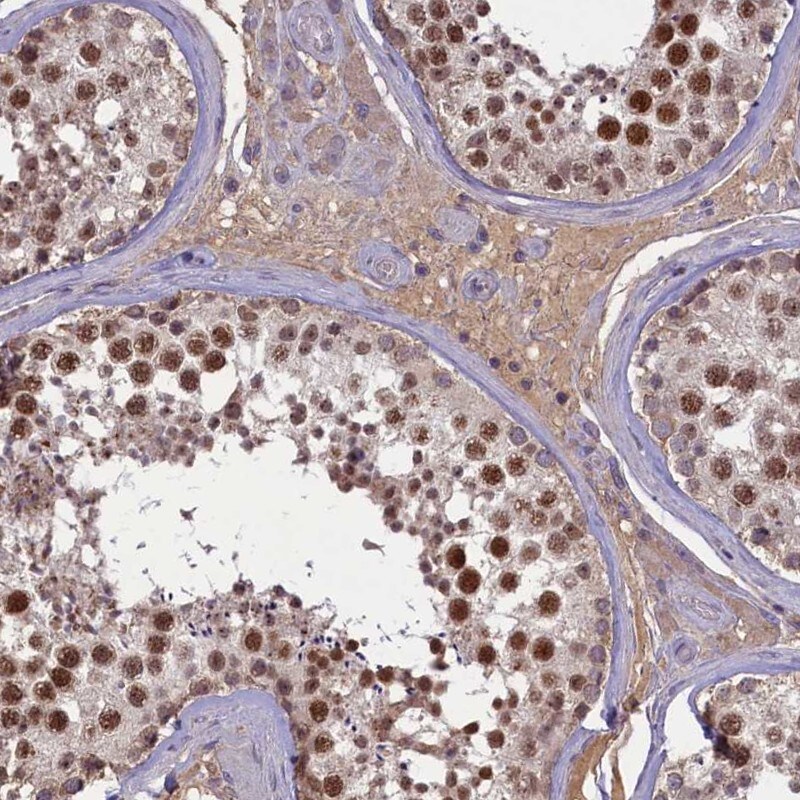 ATF7IP2 Antibody - BSA Free Immunohistochemistry-Paraffin: ATF7IP2 Antibody [NBP1-94028]