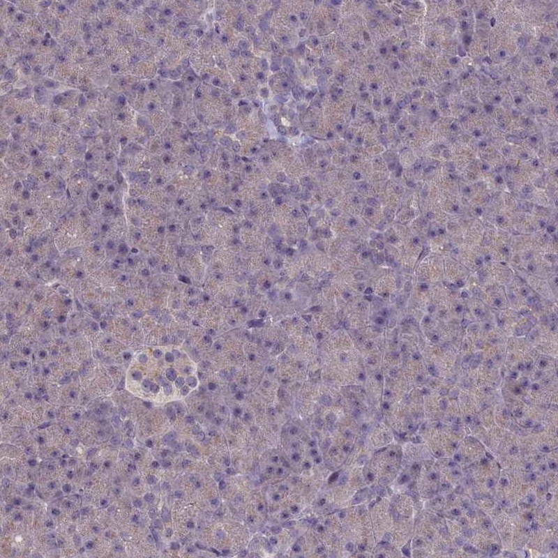 ATF7IP2 Antibody - BSA Free Immunohistochemistry-Paraffin: ATF7IP2 Antibody [NBP1-94028]