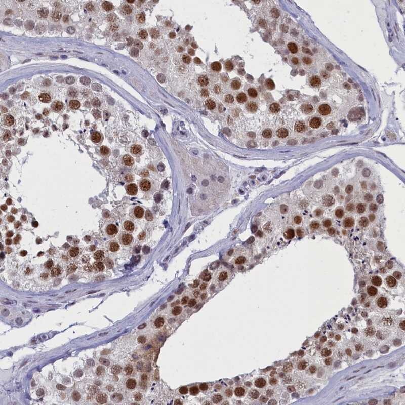 ATF7IP2 Antibody - BSA Free Immunohistochemistry-Paraffin: ATF7IP2 Antibody [NBP1-94029]