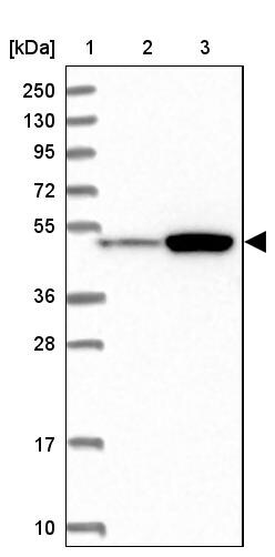 ATF7IP2 Antibody - BSA Free Western Blot: ATF7IP2 Antibody - BSA Free [NBP1-94029]
