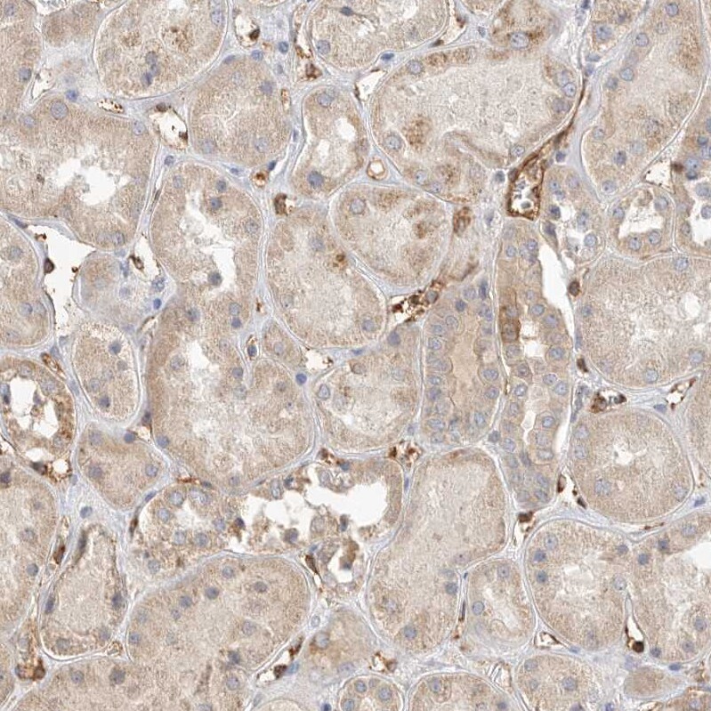 JMJD4 Antibody - BSA Free Immunohistochemistry: JMJD4 Antibody - BSA Free [NBP1-94032]