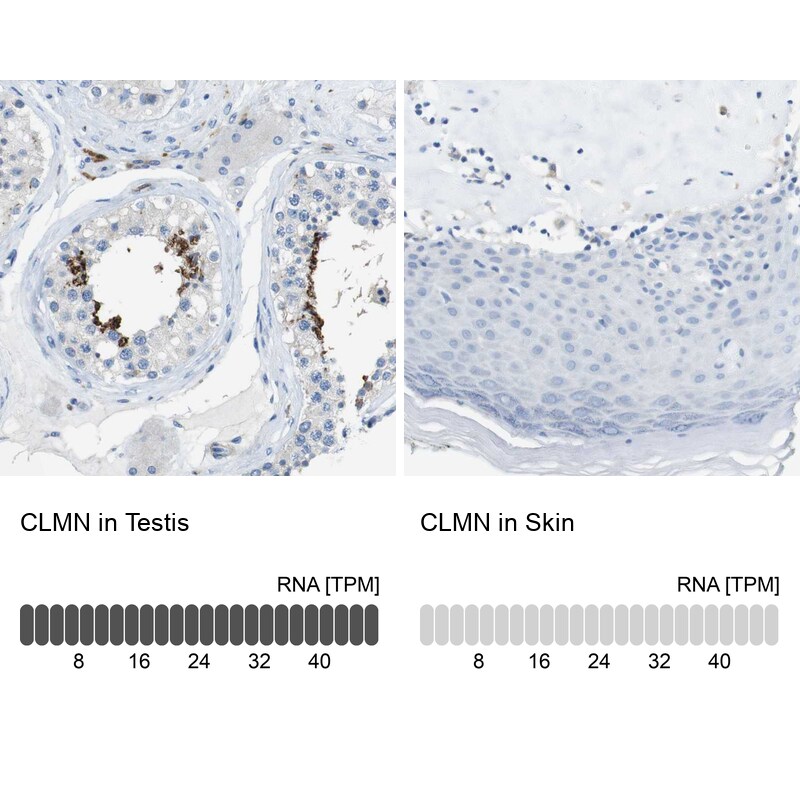 CLMN Antibody - BSA Free Immunohistochemistry: CLMN Antibody - BSA Free [NBP1-94034]
