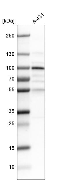 LEPREL1 Antibody - BSA Free Western Blot: LEPREL1 Antibody - BSA Free [NBP1-94041]