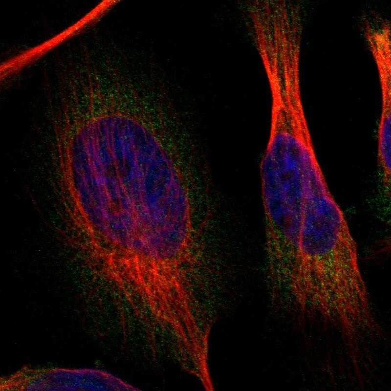 SAMD4B Antibody - BSA Free Immunocytochemistry/ Immunofluorescence: SAMD4B Antibody - BSA Free [NBP1-94045]
