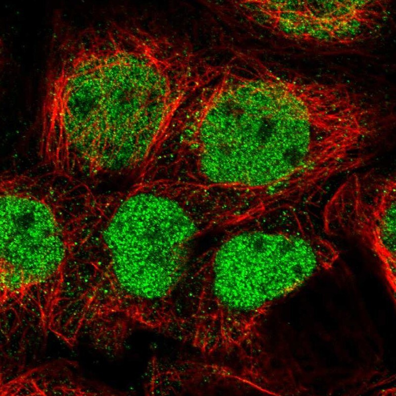 GPATCH2L Antibody - BSA Free Immunocytochemistry/ Immunofluorescence: GPATCH2L Antibody [NBP1-94046]