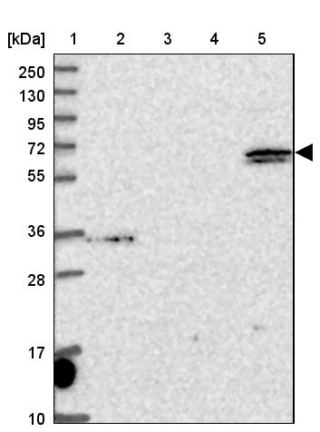 ARHGAP19 Antibody - BSA Free Western Blot: ARHGAP19 Antibody - BSA Free [NBP1-94047]