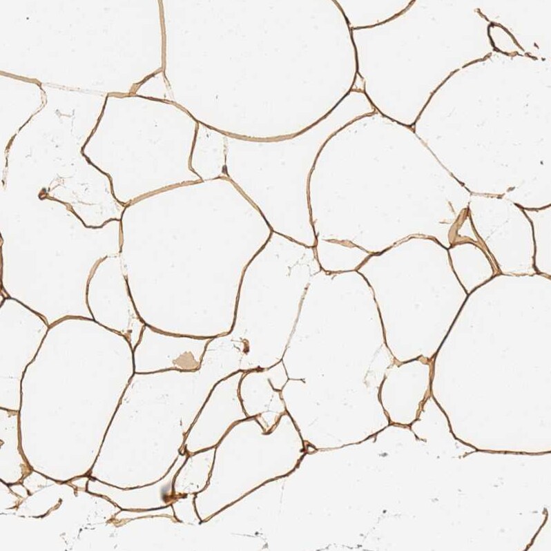 C19orf12 Antibody - BSA Free Immunohistochemistry: C19orf12 Antibody - BSA Free [NBP1-94063]