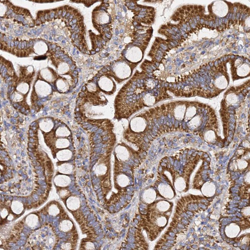 C19orf12 Antibody - BSA Free Immunohistochemistry: C19orf12 Antibody - BSA Free [NBP1-94063]