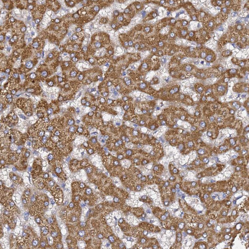 C19orf12 Antibody - BSA Free Immunohistochemistry: C19orf12 Antibody - BSA Free [NBP1-94063]