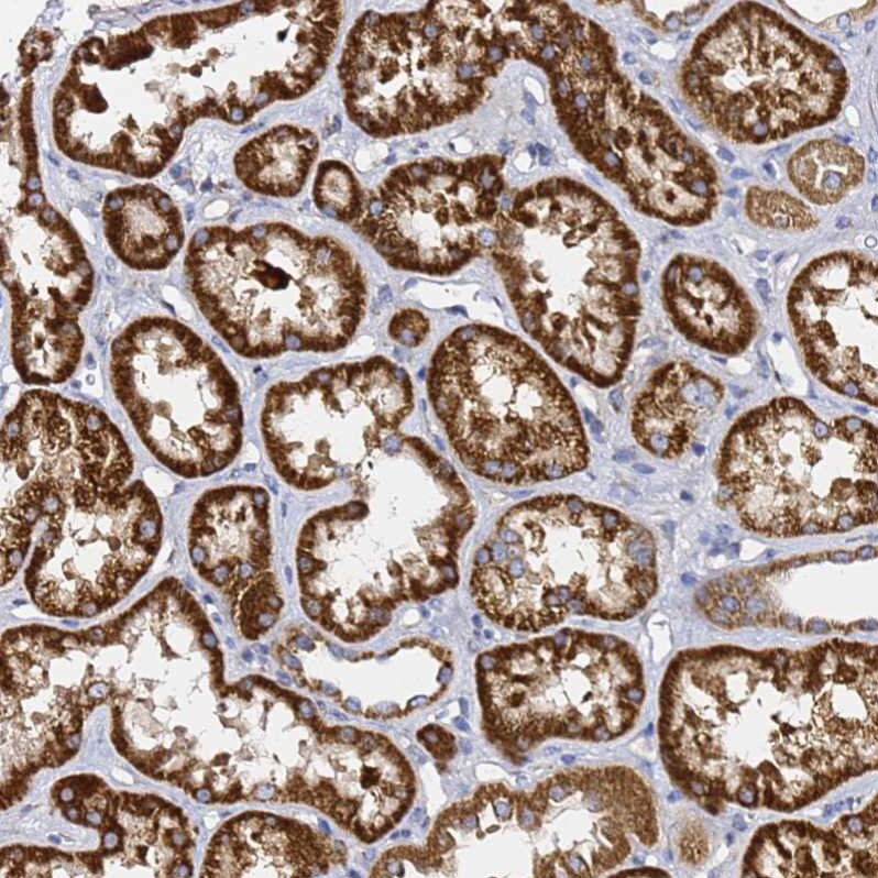 C19orf12 Antibody - BSA Free Immunohistochemistry: C19orf12 Antibody - BSA Free [NBP1-94063]