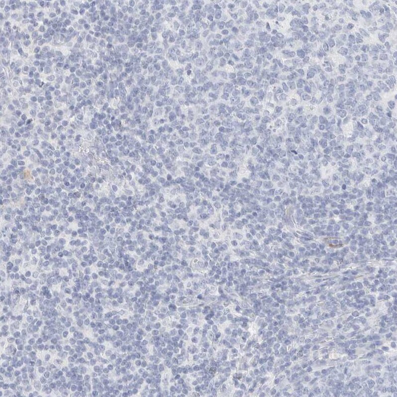 AFMID Antibody - BSA Free Immunohistochemistry: AFMID Antibody - BSA Free [NBP1-94068]