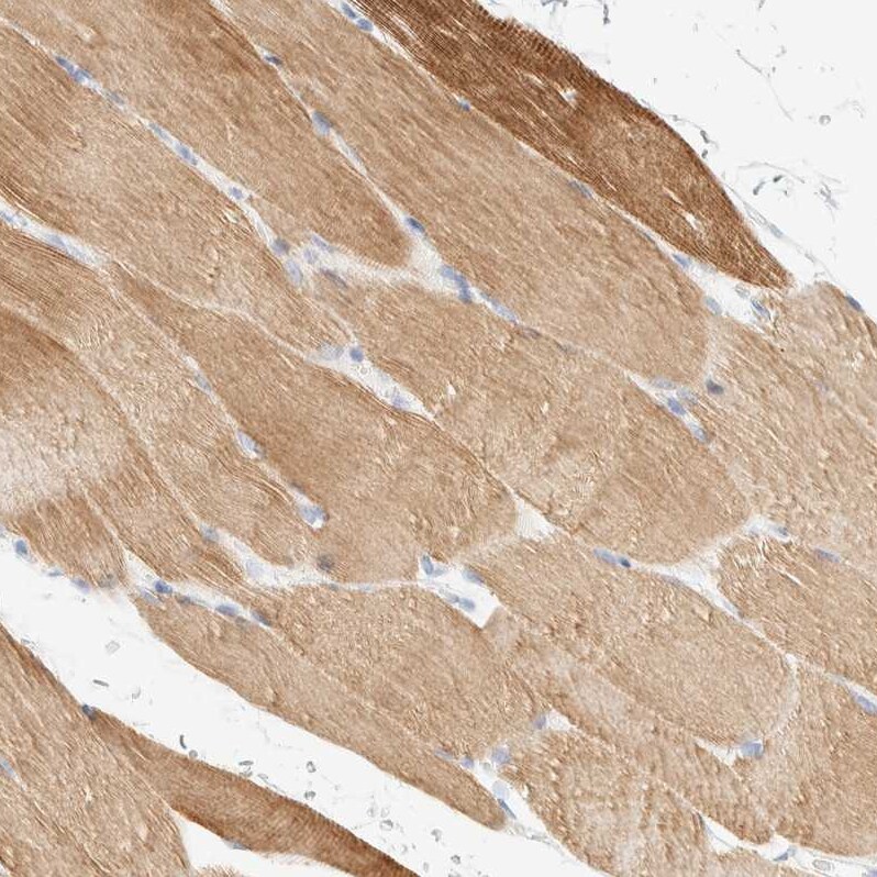 AFMID Antibody - BSA Free Immunohistochemistry: AFMID Antibody - BSA Free [NBP1-94068]