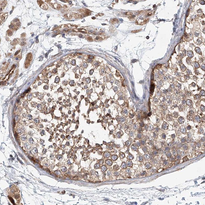 FRYL Antibody - BSA Free Immunohistochemistry-Paraffin: FRYL Antibody [NBP1-94070]