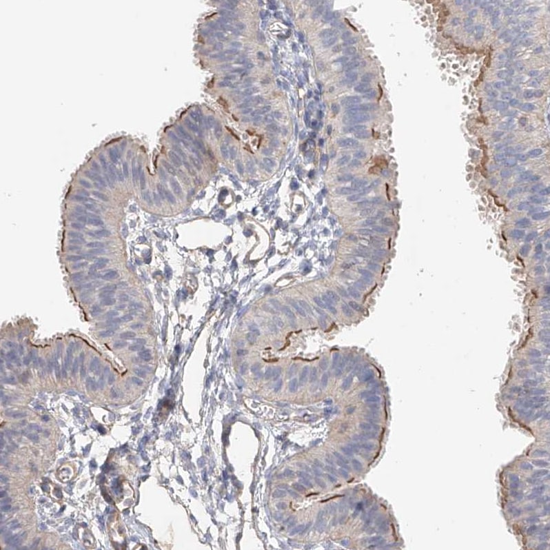 FRYL Antibody - BSA Free Immunohistochemistry: FRYL Antibody - BSA Free [NBP1-94071]