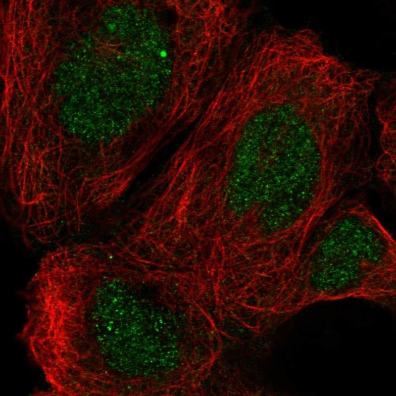 RAI14 Antibody - BSA Free Immunocytochemistry/ Immunofluorescence: RAI14 Antibody - BSA Free [NBP1-94076]