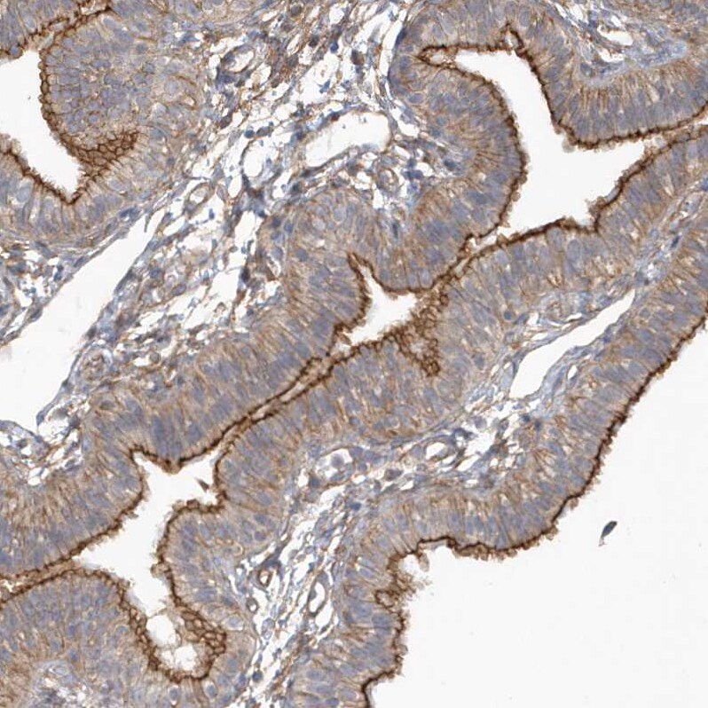 RAI14 Antibody - BSA Free Immunohistochemistry: RAI14 Antibody - BSA Free [NBP1-94076]