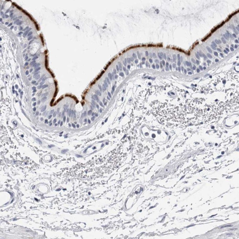 ERICH3 Antibody - BSA Free Immunohistochemistry: ERICH3 Antibody - BSA Free [NBP1-94077]