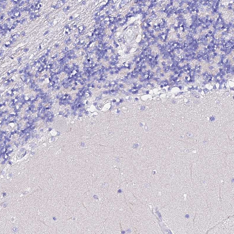 TMEM117 Antibody - BSA Free Immunohistochemistry: TMEM117 Antibody - BSA Free [NBP1-94078]