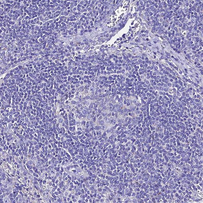 TMEM117 Antibody - BSA Free Immunohistochemistry: TMEM117 Antibody - BSA Free [NBP1-94078]